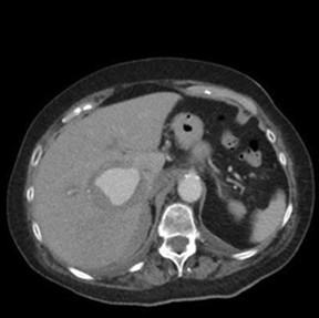 AppliedRadiology tweet media