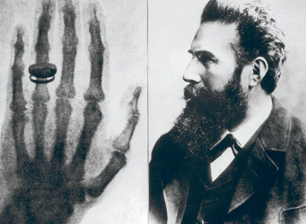 It was #OnThisDay in 1896 that the X-ray machine was exhibited for the first time: bit.ly/2PGXheE