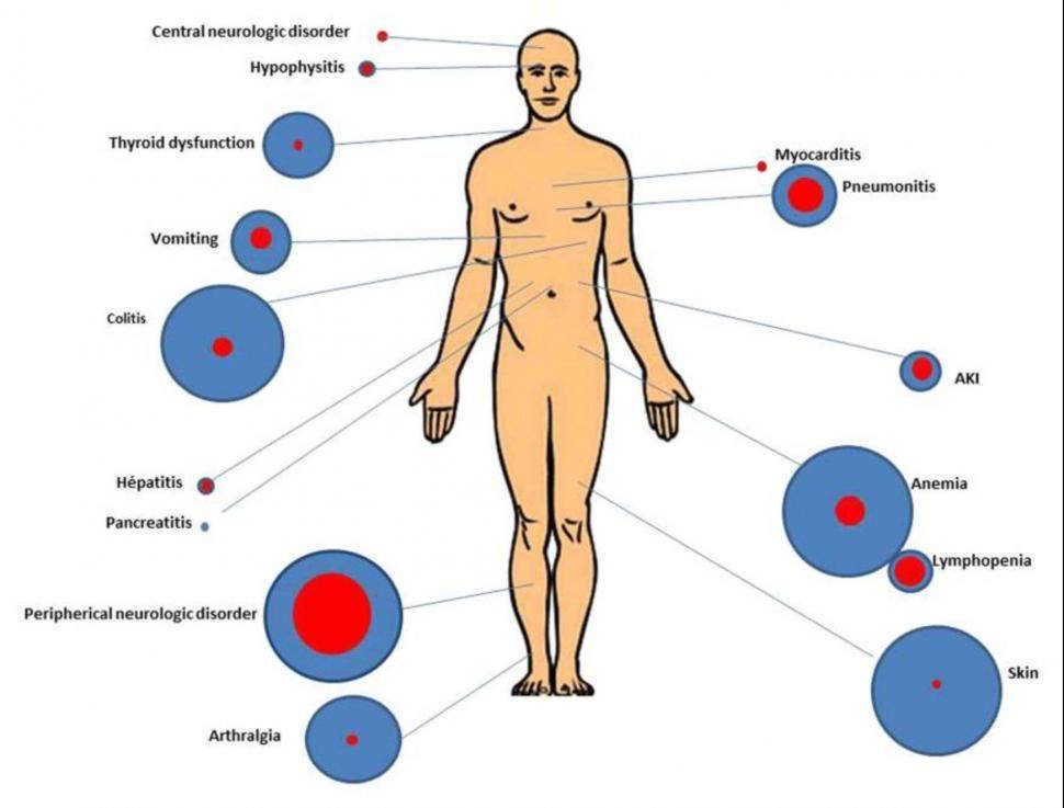 Los medicamentos de #inmunoterapia, al igual que cualquier medicamento, pueden causar efectos secundarios, incluidas complicaciones raras que para algunos pacientes pueden ser potencialmente mortales. #ConoceMás con el siguiente enlace del #NCI cancer.gov/news-events/ca…

#Oncología