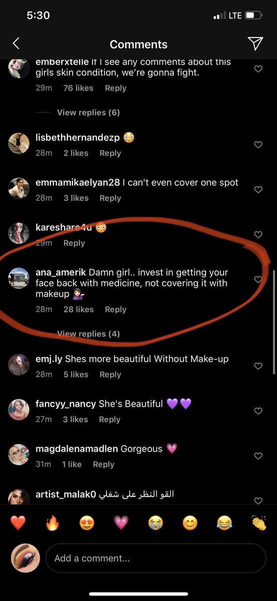 yousuckalysea_'s tweet photo. ABH reposted someone’s video and the comments have me FURIOUS
WHY DO PEOPLE SUCK!?
I swear y’all are some shitflowers https://t.co/501Uk3hxEi