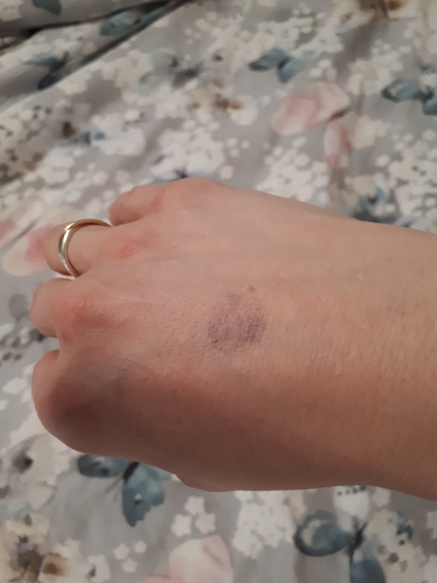 NBoltNotts's tweet photo. When this used to mean you'd been out clubbing....and now it means you've been to a trampoline park with the kids 😣 #mummyproblems #handstamp @TheUnmumsyMum https://t.co/5BPHC4pXjw