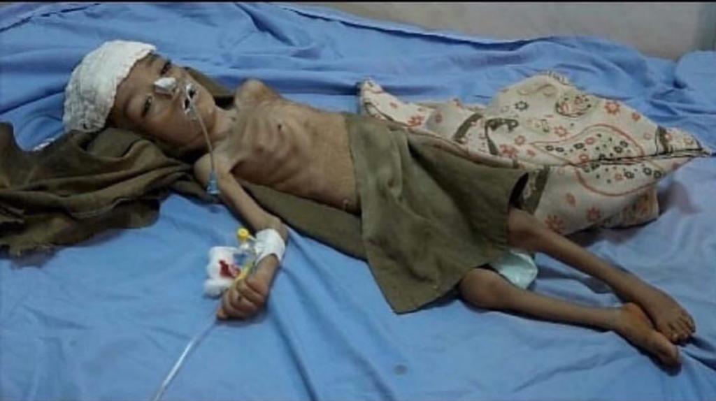 Political analyst 🇾🇪🇵🇸 tweet media