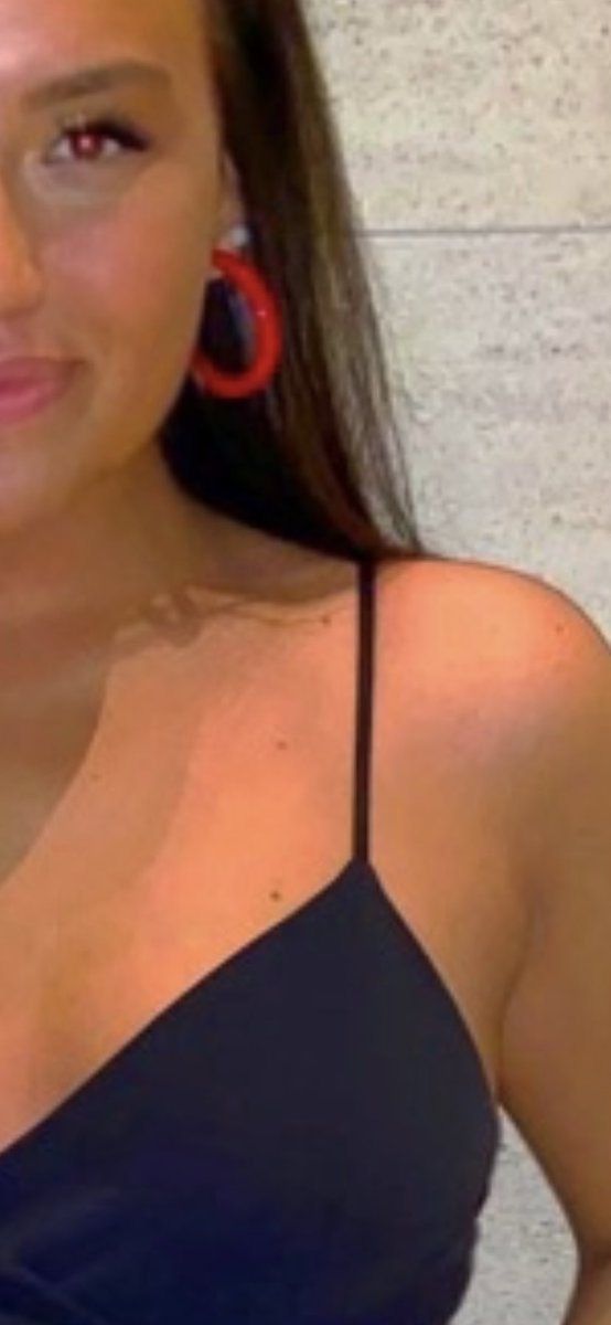madisonanthonyy's tweet photo. I have 3 freckles that line up perfect in a straight line &amp; it’s truly concerning me that maybe I’ve been.. marked for something https://t.co/jq2oqk4XOf