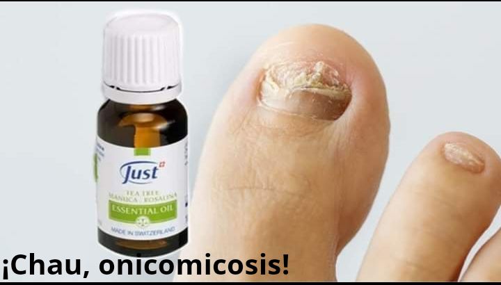 BellsManosyPie2's tweet photo. Tratá la onicomicosis con aceite de Tea Tree.
https://t.co/bZt08N73eo
#ADomicilio #ZonaNorte #ZonaNoroeste #GranBsAs #Salud #Unisex #Estetica #Spa #Pies #Manos #Pedicuria #Manicuria #Esculpidos #Acrilico #Gel #Polygel #Esmaltado #Tradicional #Semipermanente #Capping #Acripie https://t.co/VUkvsANMxi
