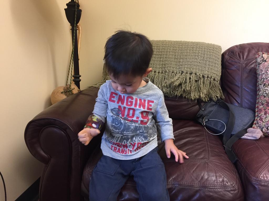myHandspring's tweet photo. Look who got his 1st prosthesis! He was quickly on his scooter having lots of Fun! It's moments like these that always bring a smile to our faces &amp; in our hearts #prosthetics #enrichinglives #smiles #scooterfun #handspringprosthetics #childamputee #congenital #myhandspring #TRS https://t.co/Tf7dLo2WDc