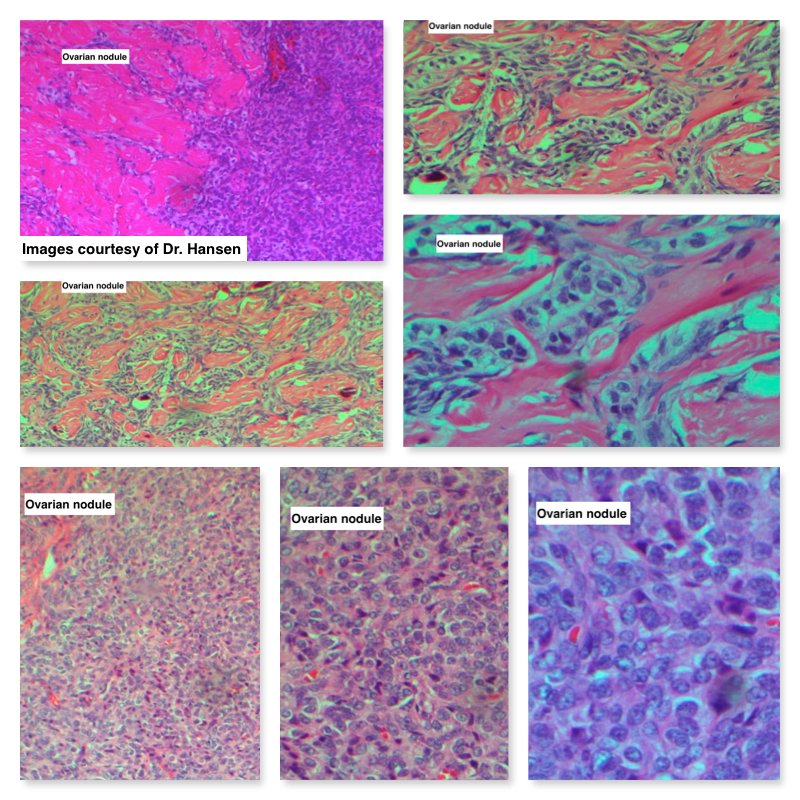 South Bay Pathology tweet media