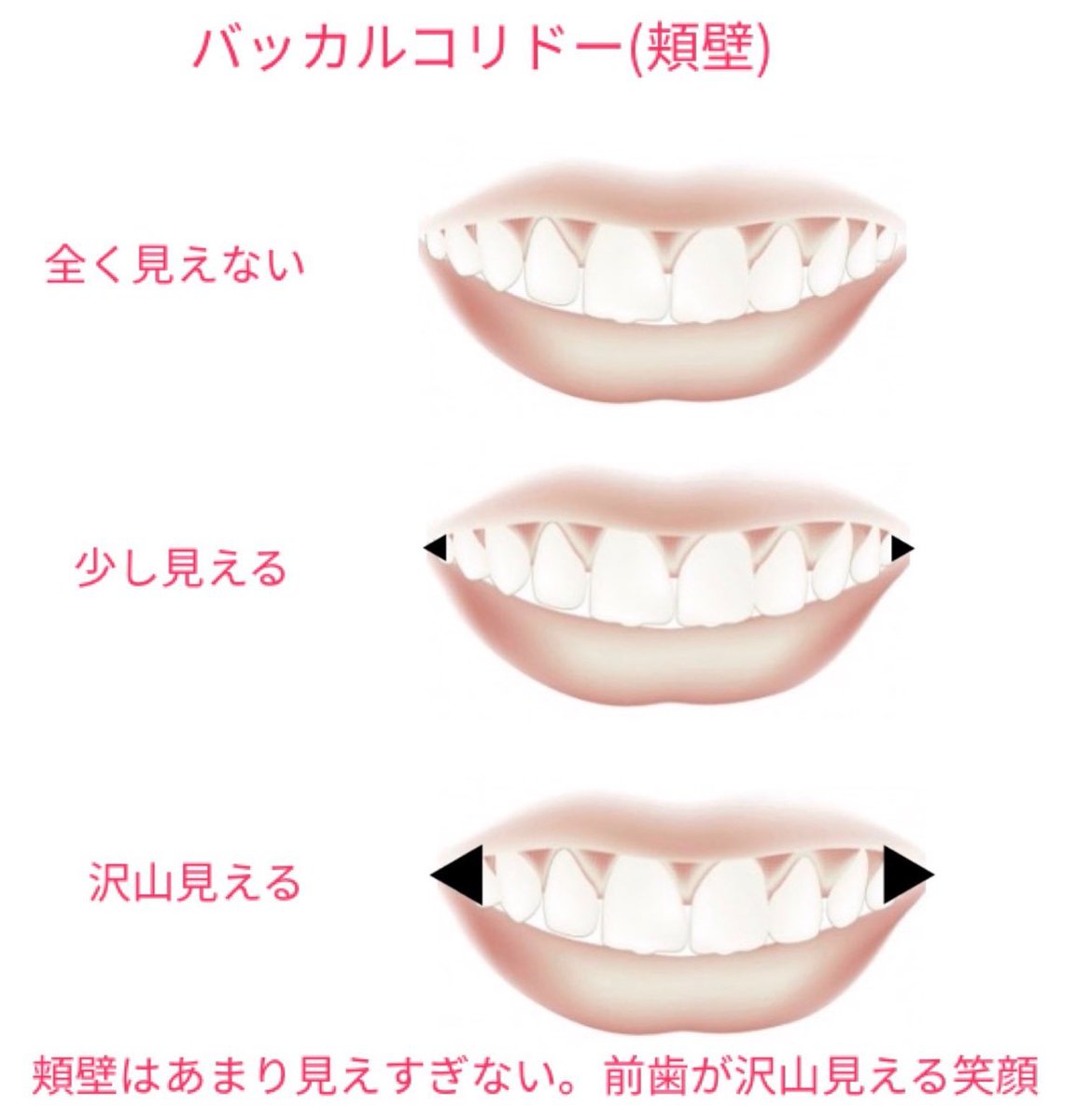 𓂃 室長さん バッカルコリドーってそんなに気にする必要あるのか 石原さとみも新垣結衣も頬壁見えてるんだが 綺麗な笑顔は前歯が沢山見える方が大事 𓂃 室長さん バッカルコリドーってそんなに気にする必要あるのか 石原さとみも新垣結衣も頬壁見えてるんだが 綺麗な笑顔は前歯が沢山見える方が大事
