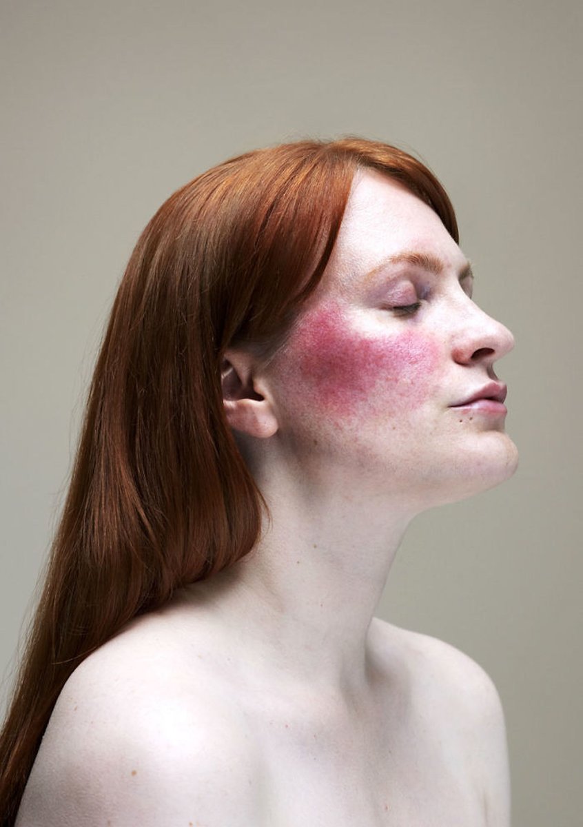 creapills's tweet photo. Ce projet photo sans maquillage célèbre les femmes naturelles et leurs problèmes de peau

Plus d'infos : https://t.co/7vzDl7Hub4 https://t.co/n9E7jTynMi