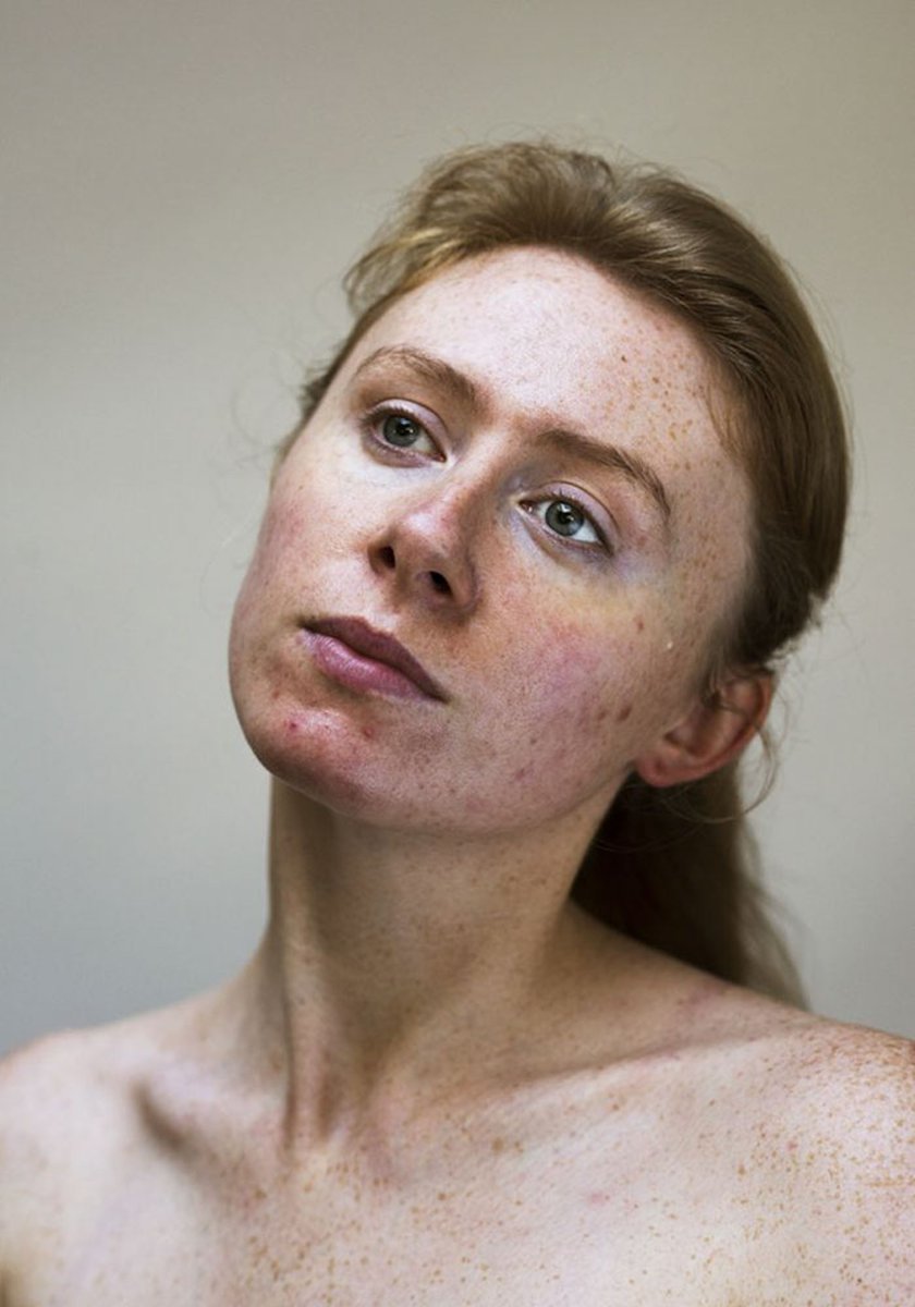 creapills's tweet photo. Ce projet photo sans maquillage célèbre les femmes naturelles et leurs problèmes de peau

Plus d'infos : https://t.co/7vzDl7Hub4 https://t.co/n9E7jTynMi
