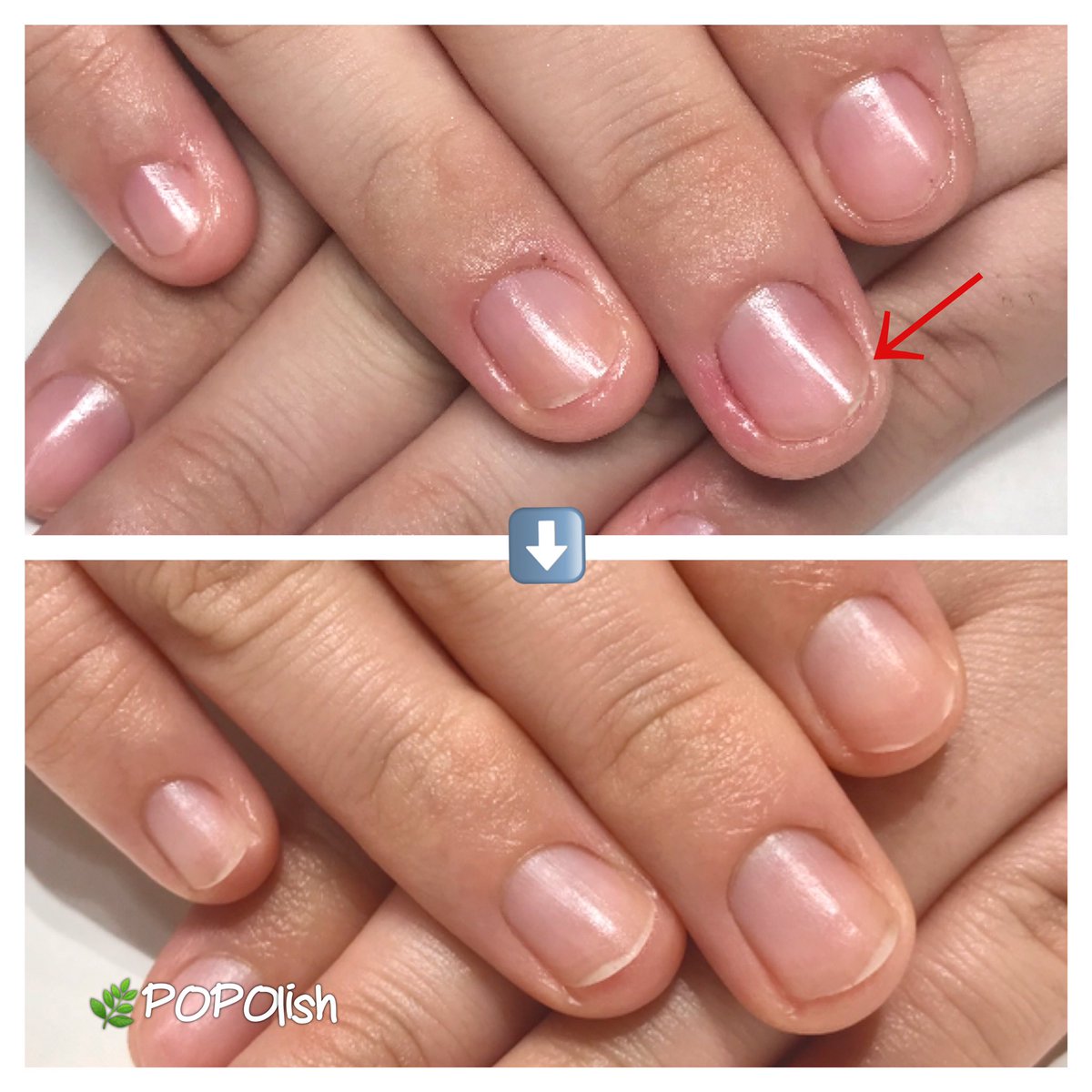 深爪ケア Hashtag On Twitter