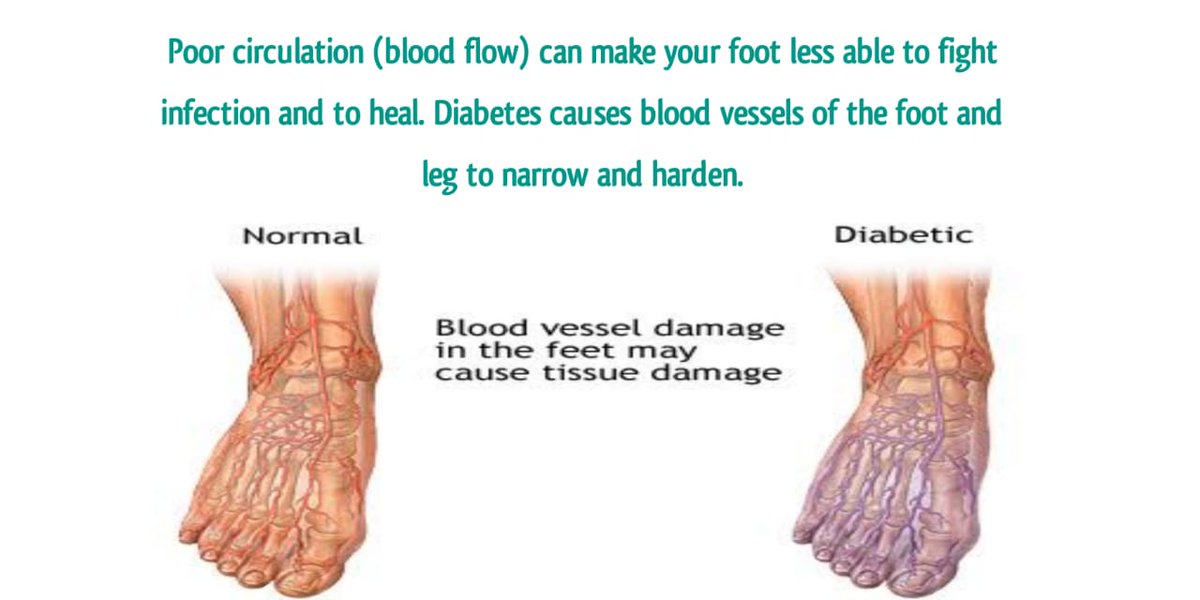 Bermuda Diabetes Association tweet media