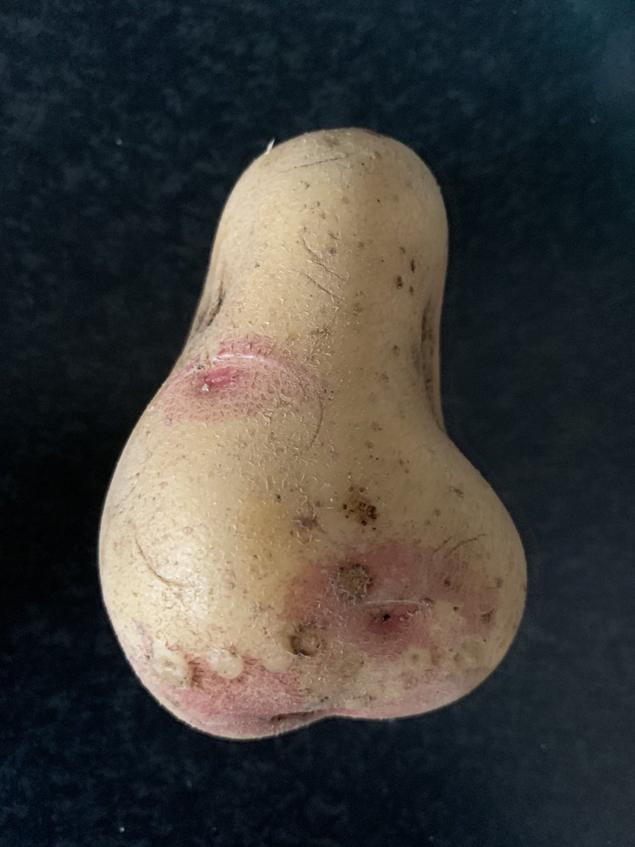 Ben Tompkinson (@ben_tompkinson) on Twitter photo Not so much a spud as a “stud” this one... finally the Mrs gets more than a mouthful 🤣. Thanks <a href="/sainsburys/">Sainsbury's</a> 😳 Not so much a spud as a “stud” this one... finally the Mrs gets more than a mouthful 🤣. Thanks <a href="/sainsburys/">Sainsbury's</a> 😳