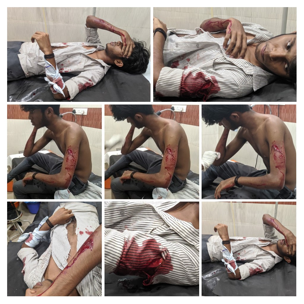ABVPKonkan's tweet photo. SFIच्या गुंडांनी पुन्हा एकदा अभाविपच्या कार्यकर्त्यांवर केला केरळ मध्ये क्रूरपणे हल्ला...
#leftists_are_terrorists
#LeftGoons https://t.co/23s2wAKOO4