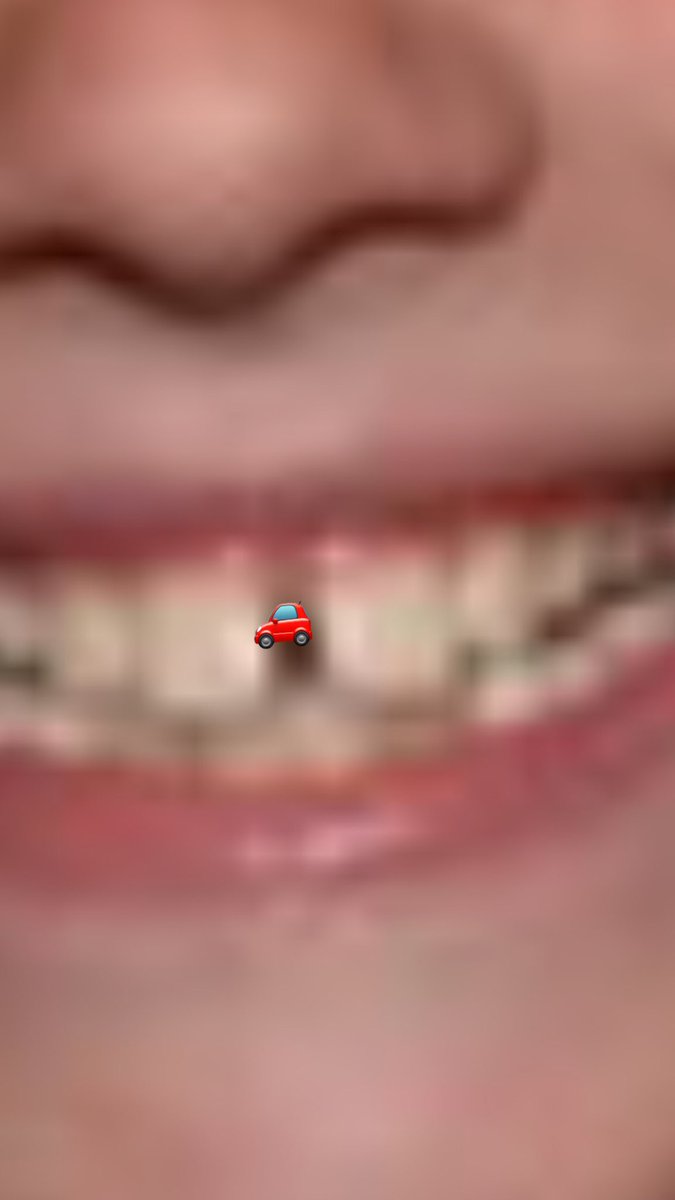 garrettl_f's tweet photo. Who needs a two car garage when you got a gap this big? I liked my teeth how I like my essays... double spaced. https://t.co/Zc1bHW7V75