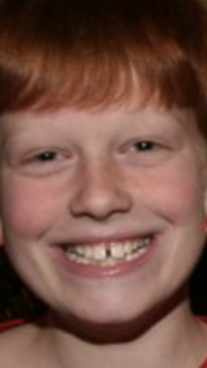 garrettl_f's tweet photo. Who needs a two car garage when you got a gap this big? I liked my teeth how I like my essays... double spaced. https://t.co/Zc1bHW7V75