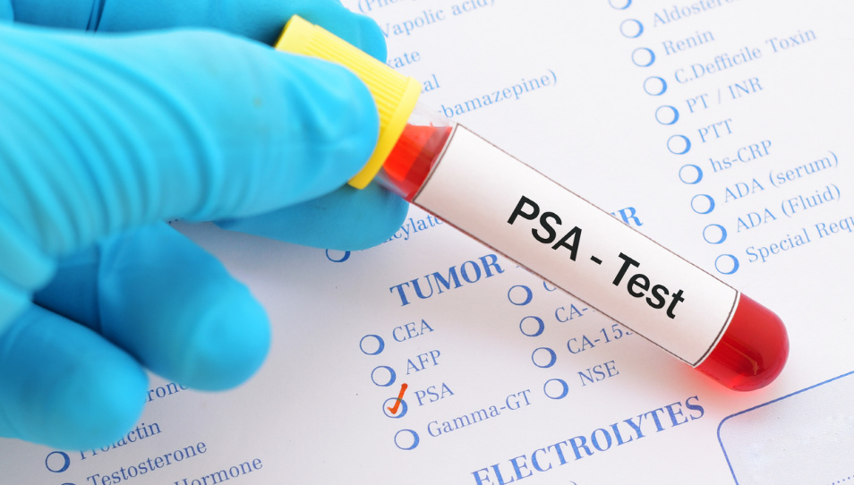 miVIPSurgery's tweet photo. Read the blog on why men should still get a PSA test as an early warning screening for prostate cancer: https://t.co/DL3zojT7GN
#prostatecancer #psa #prostatectomy #roboticprostatectomy #urology #urologist #mivip #minimallyinvasive #menshealth https://t.co/dCHdk5itTg