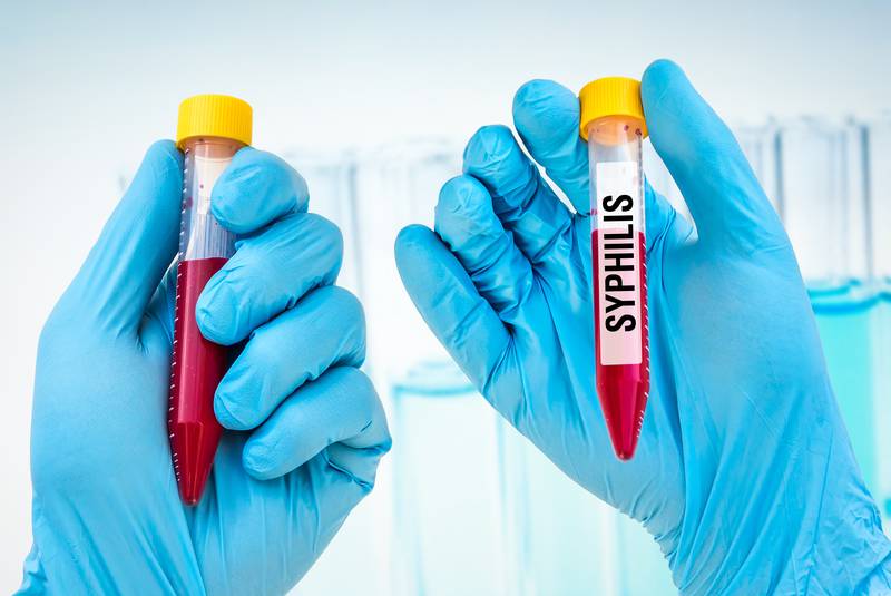 IntimacyKit's tweet image. Nova Scotia declares syphilis outbreak! #syphilis #safesex #intimacykit #gettested
atlantic.ctvnews.ca/health-officia…