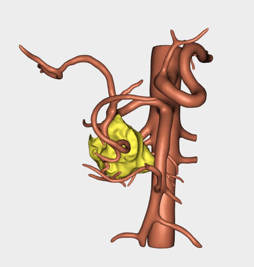 HBP_ClinicoValencia tweet media
