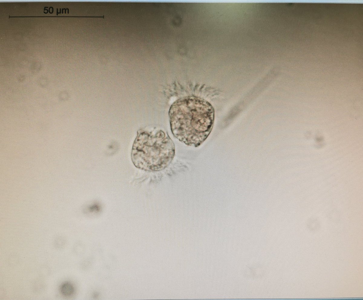 MetuLimnology's tweet photo. Counting frenzy @MetuLimnology zooplankton, ciliate, phytoplankton #daphnia, #strobilidiumcaudatum, #vorticellaoctava, samples from last year experiment, 2019 #DOC, #Huminfeed @aquacosm @BekliogluMeryem https://t.co/FPeB6rEvFG