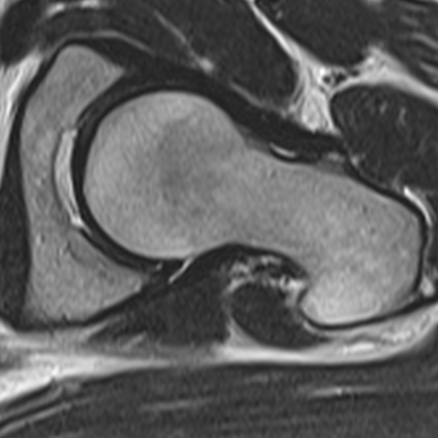 Ara Kassarjian, MD, FRCPC tweet media