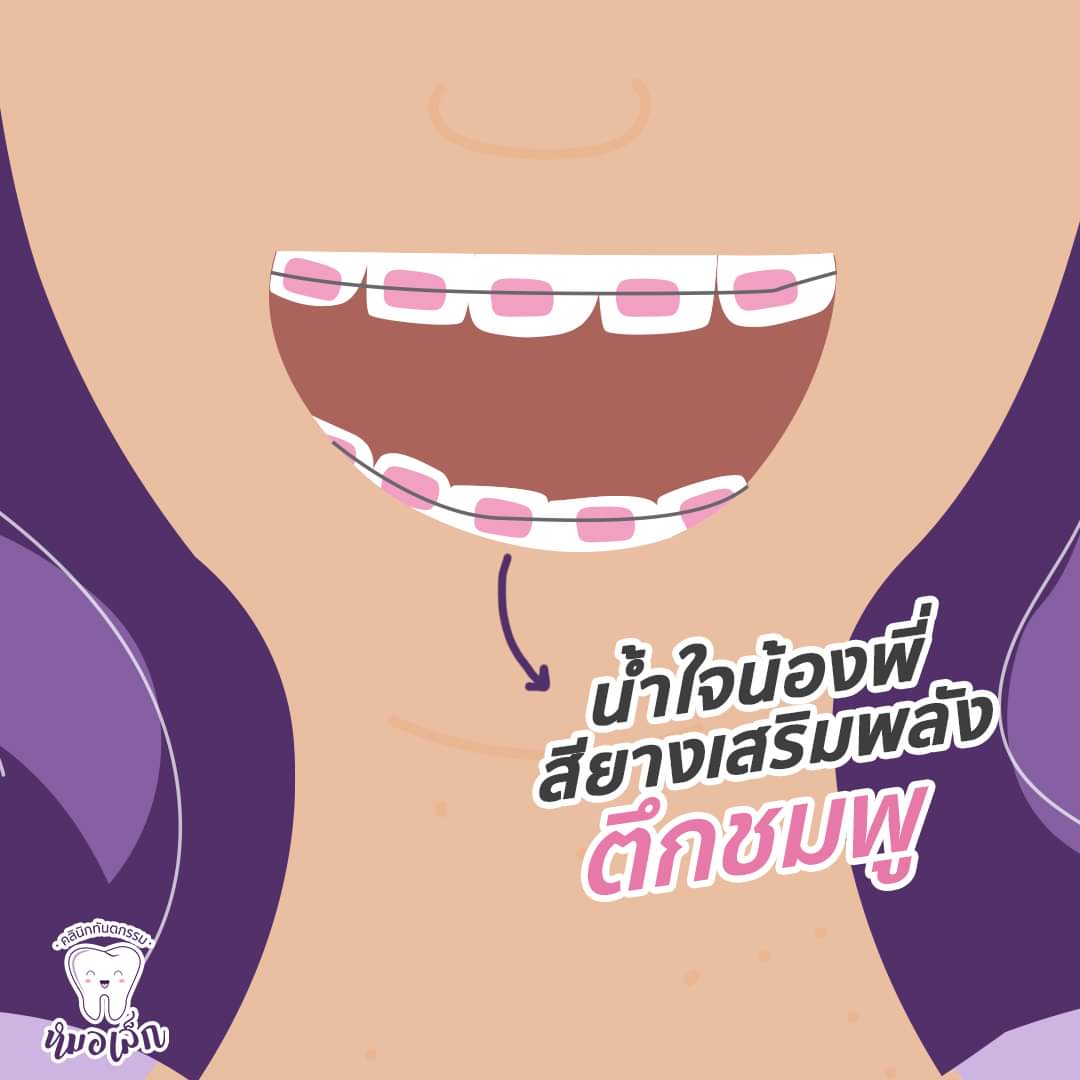 เพื่อนขอลิ้งเพจคลินิกที่ไปอุดฟันมา เข้าไปเหนคอนเท้นสียางจัดฟันแบบ อินไซต์มาก หมอค้า หมออยู่ในนี้แน่ๆ5555555555555555555555555555555555555555555555555