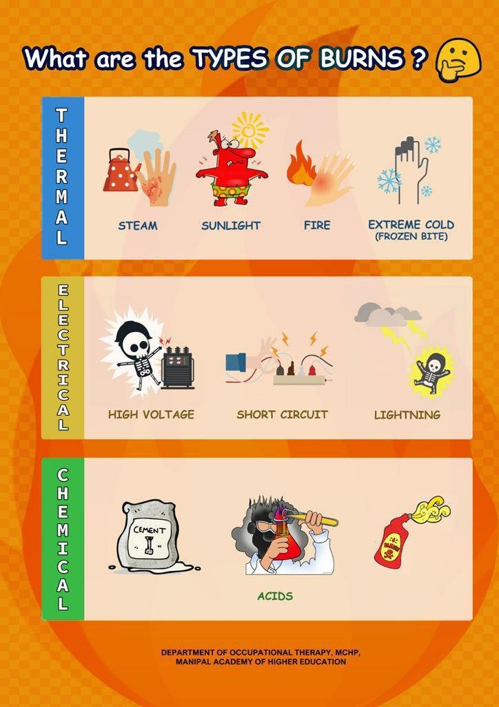 OT_MCHP_MAHE's tweet photo. #BurnAwarenessWeek Role of #OccupationalTherapy
@OT_MCHP_MAHE @MCHP_MAHE @ManipalUni @kmc_manipal @KMC_Mangalore @maiya_dr @BellurRajashek1 @VinitaAcharya6 https://t.co/9v9O3Ihd7P