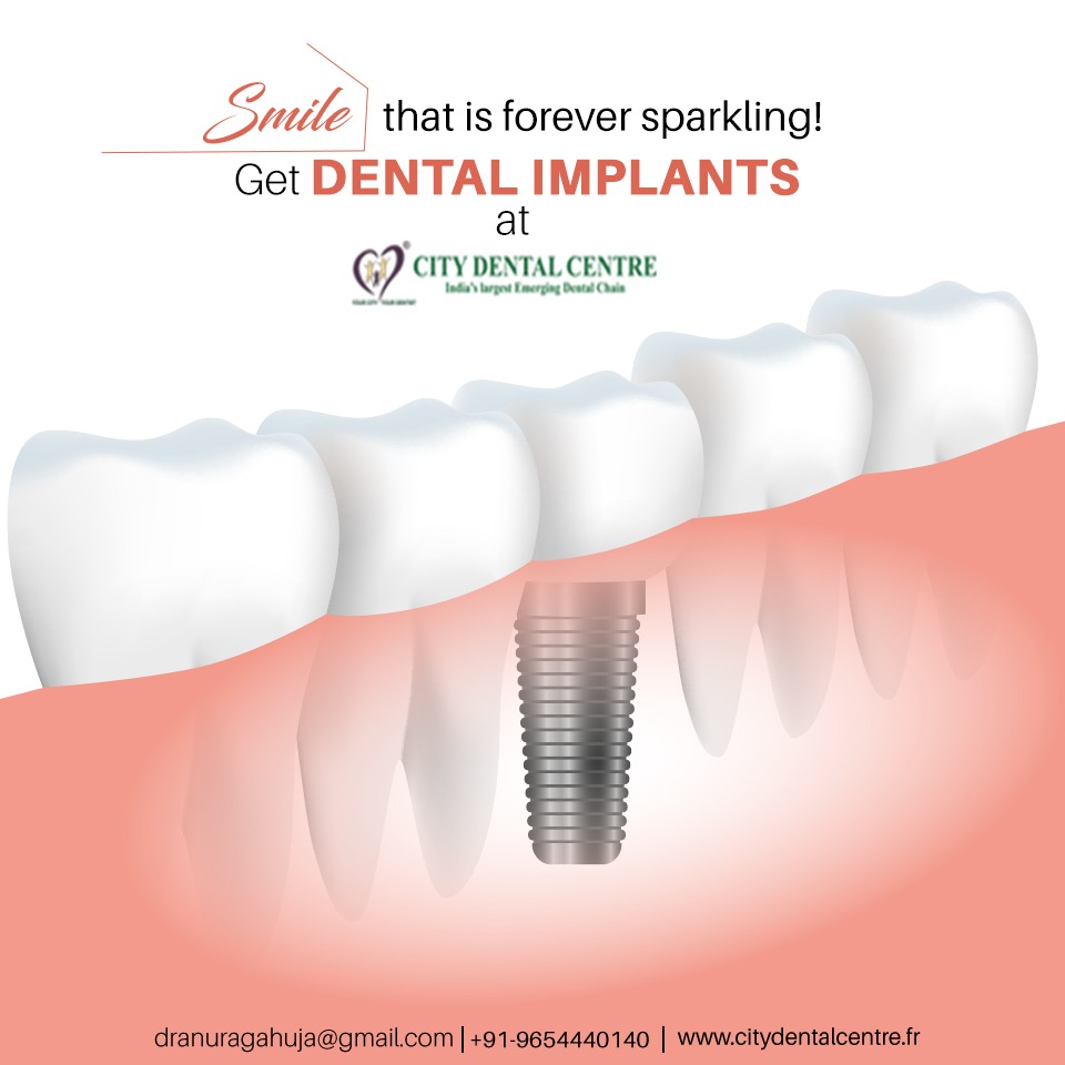 cdc_europe's tweet photo. With City Dental at your service, leave no stone unturned in donning a blossoming smile! Get reliable implants solution to your missing teeth, affordable and everlasting. Enquire now!!!
Call us – +91 9654440140
Visit:https://t.co/EzFER83Pd4
#CityDentalCentre  #dentalcare #indai https://t.co/SAWjfQfSLM