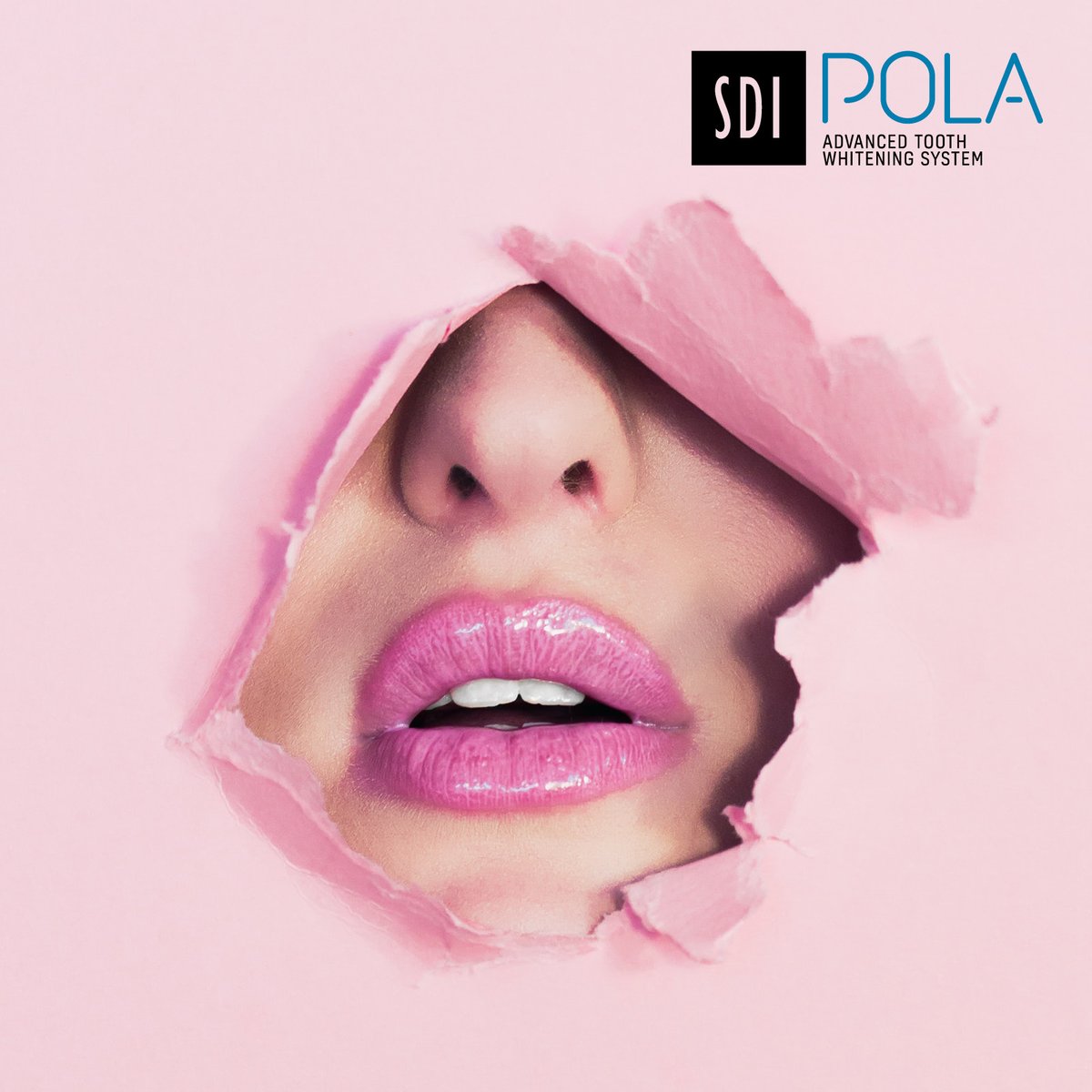 sdidentaluk's tweet photo. Offer your patients the whitening solution that suits them with poladay and polanight take-home whitening! Discover more at: https://t.co/rsbocjndqA #polawhitening #polanight #poladay https://t.co/ll79TuFk3E
