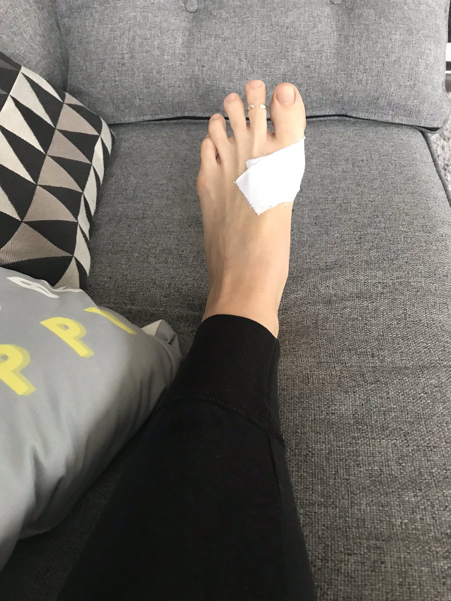 lt_fitness81's tweet photo. Interesting morning! Lovely chatty run with friends followed by physio with the amazing @amyryan1980 which resulted in acupuncture in my bottom and a taped up toe! Who said running was good for you!
#running #acupuncture #marathontraining #ragnartraining #sportsinjuries https://t.co/q8alP5KKGM