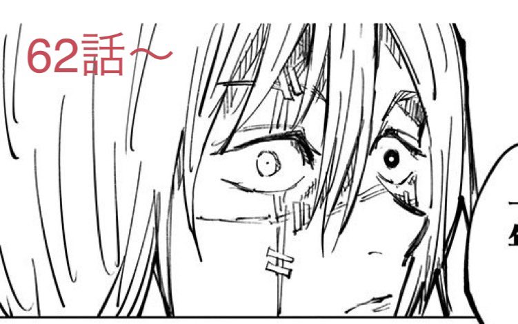 海のもくず Pa Twitter 真人くんの縫い目の描き方の変遷ダイジェスト とlineスタンプ 細めの二本糸 絆創膏やテープみたいなやつ なんか両端に丸いのがあって糸が太め 海のもくず Pa Twitter 真人くんの縫い目の描き方の変遷ダイジェスト とlineスタンプ 細めの二本糸 絆創膏やテープみたいなやつ なんか両端に丸いのがあって糸が太め