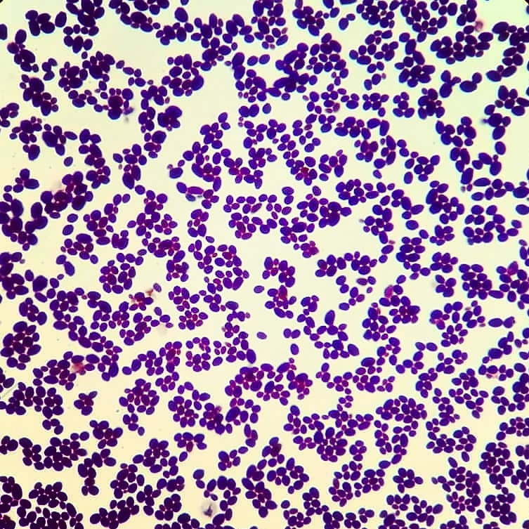 ImgenesMicrosc1's tweet photo. Candida tropicalis bajo el microscopio a 40x de aumento, teñida con la coloración de Gram. https://t.co/HbOd0ntprU
