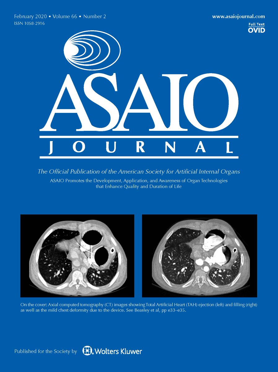 asaiojournal's tweet image. The new issue is online! ow.ly/LZil50yc9hL

#HeartTx #LVAD #MCS #thrombosis #hemodynamics #exercise #ECMO #cardiogenicshock #biomaterials #TAVR #SingleVentricle #ECLS #pediatrics #TAH Several articles are #FREE