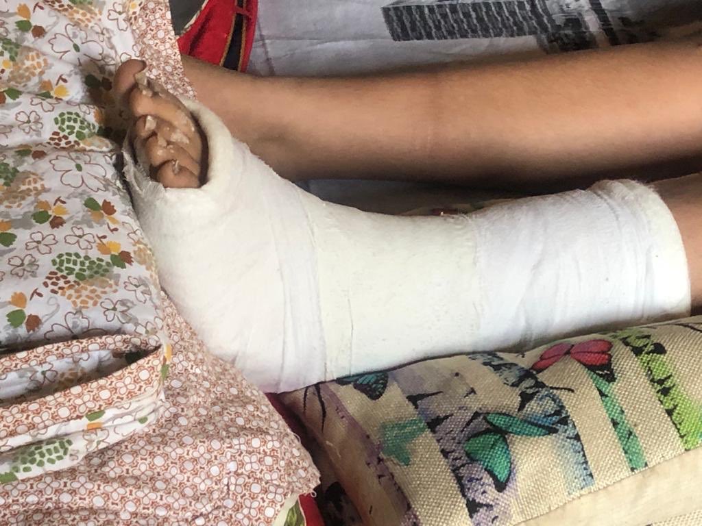 bhavreen kandhari on twitter this is our posh defencecolony there hv been innumerable complaints for this decrepit road on the d block side fr over a yr we were told that its posh defencecolony there hv