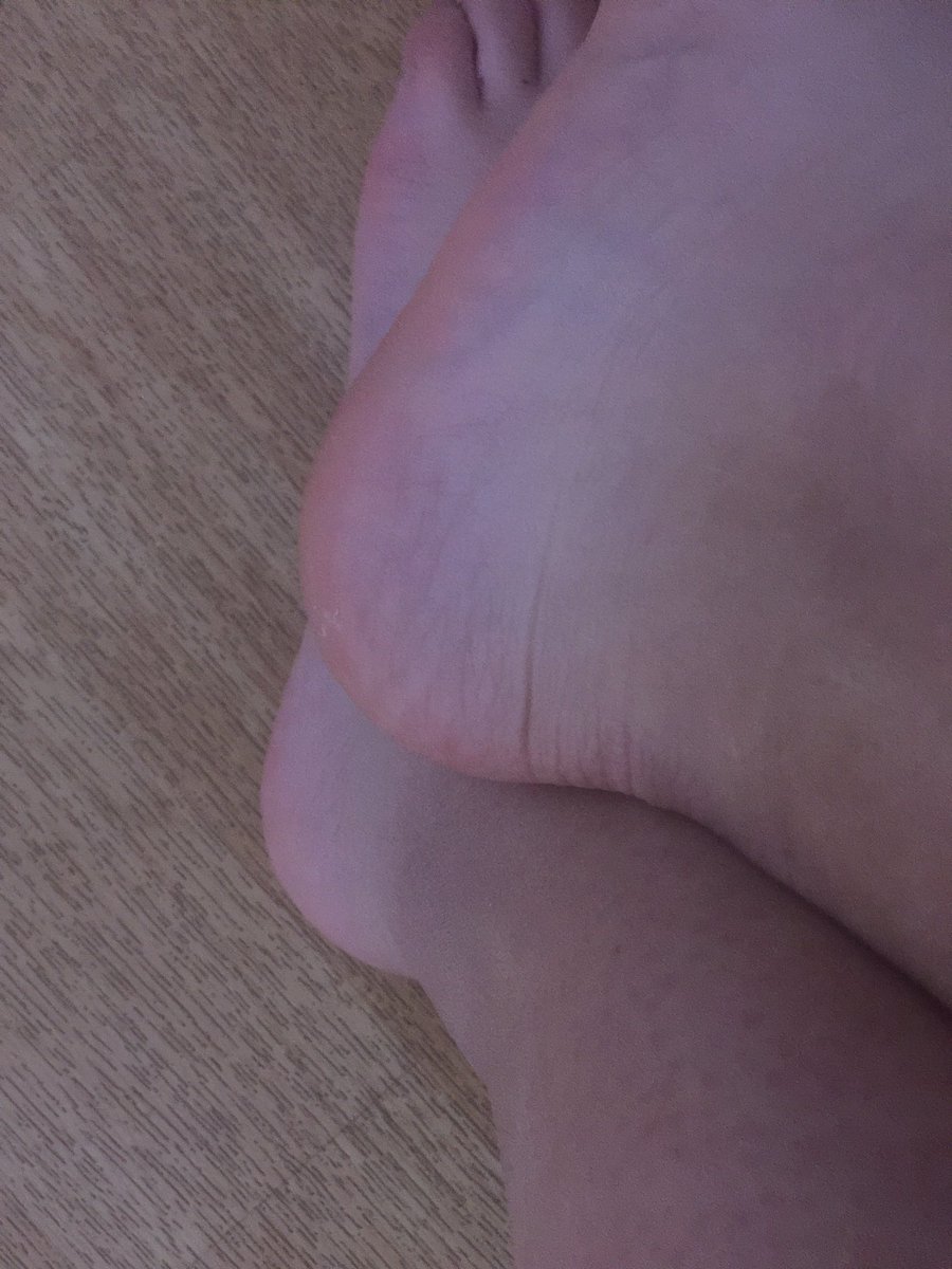 KeynaTns's tweet photo. Jai les pieds grv sales venez me les laver
#soumission #moneyslave #pieds #paypal #esclaves #argents #soumis https://t.co/xoLoHyvr4j