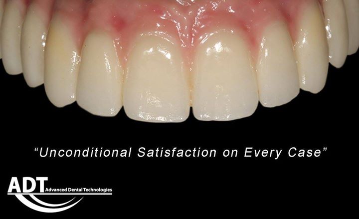 AdvDntlTech's tweet photo. https://t.co/kMjqf92qGZ

#ADT #AdvancedDentalTechnologies #LoveOfTeeth #ToothArt #Dentistry #Dental #GC #Zirconia #FullMouthRestoration #DentalLab #SendUsYourScans #SendUsYourImpressions https://t.co/5eJN07EYqj