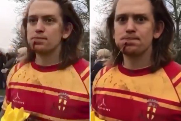 Water Shoots Out of Hole Injured Rugby Players Chin (freaky video)
#wtf #MedwayRC thefreaky.net/water-shoots-o…