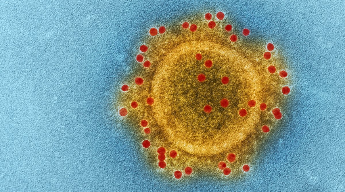Microscopic view of a coronavirus sample
