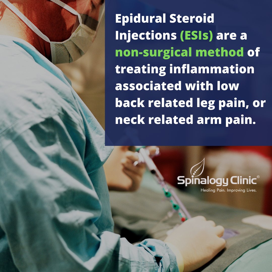 Spinalogy Clinic on Twitter "Epidural Steroid Injections (ESIs) are a