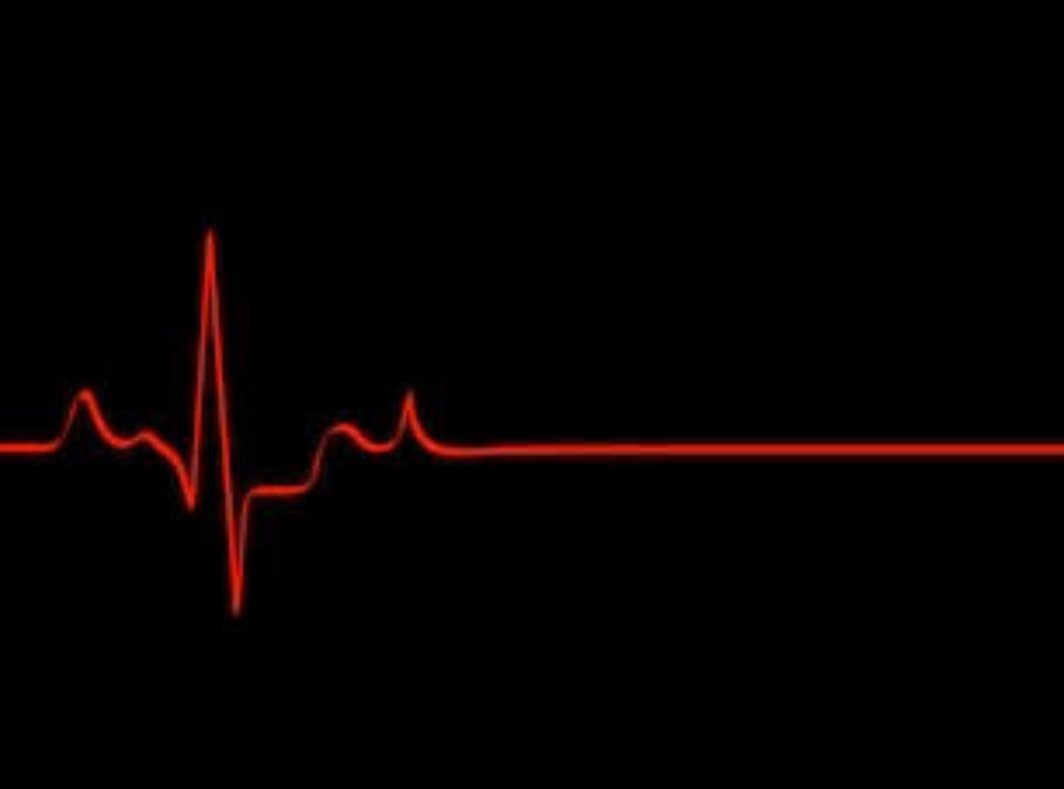 alaika_abdullah's tweet image. Sejauh napas masih berhembus, maka grafik kehidupan ini akan terus bergerak, naik turun, bergelombang dan tidak akan pernah datar. Karena garis datar adalah pertanda kematian! 
#happyblogwalking #TuesdayMotivation