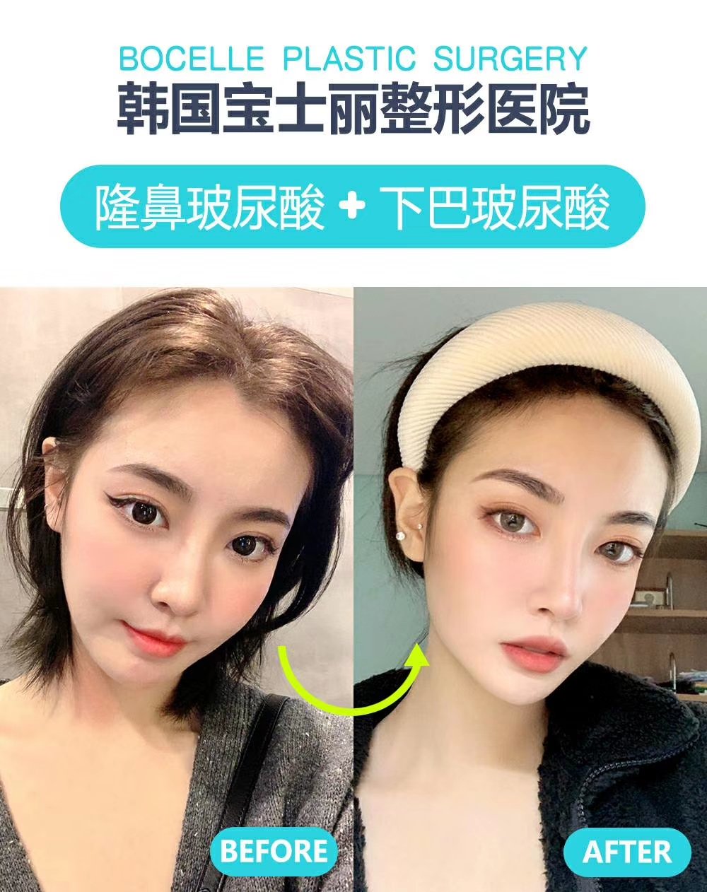 韓國寶士麗整形醫院 Spmoq19tpouonux Twitter
