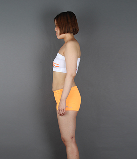 365mcGlobal's tweet photo. [B &amp; A]

Procedure: Liposuction, Whole Body

🔸 Email : doctor@365mcglobal.com
🔸 Procedure : https://t.co/WssyXxv2x4

#liposuctionkorea
#365mcliposuction
#365mchospital #surgery
#liposuctionrecoverytime
#localanesthesia #fat #body
#365mcliposuctionhospital #fatbelly https://t.co/D8lp5zgzCt