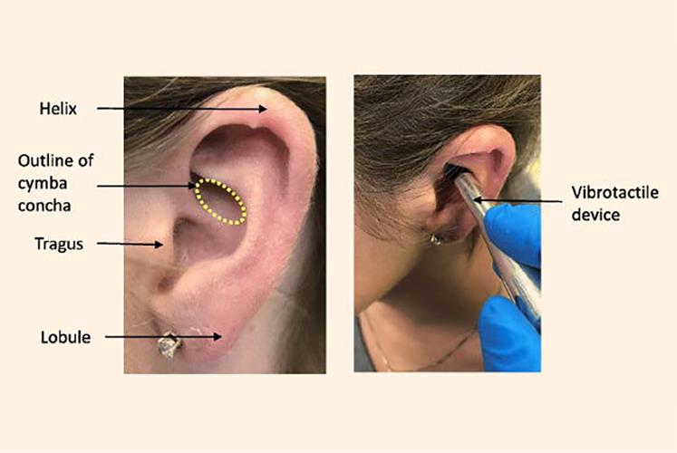 ReflectNeuro's tweet image. There's a surprisingly effective way to calm that fight-or-flight stress response when it feels overpowering.
Read: tinyurl.com/tz3ottz
#ReflectNeuropsychology