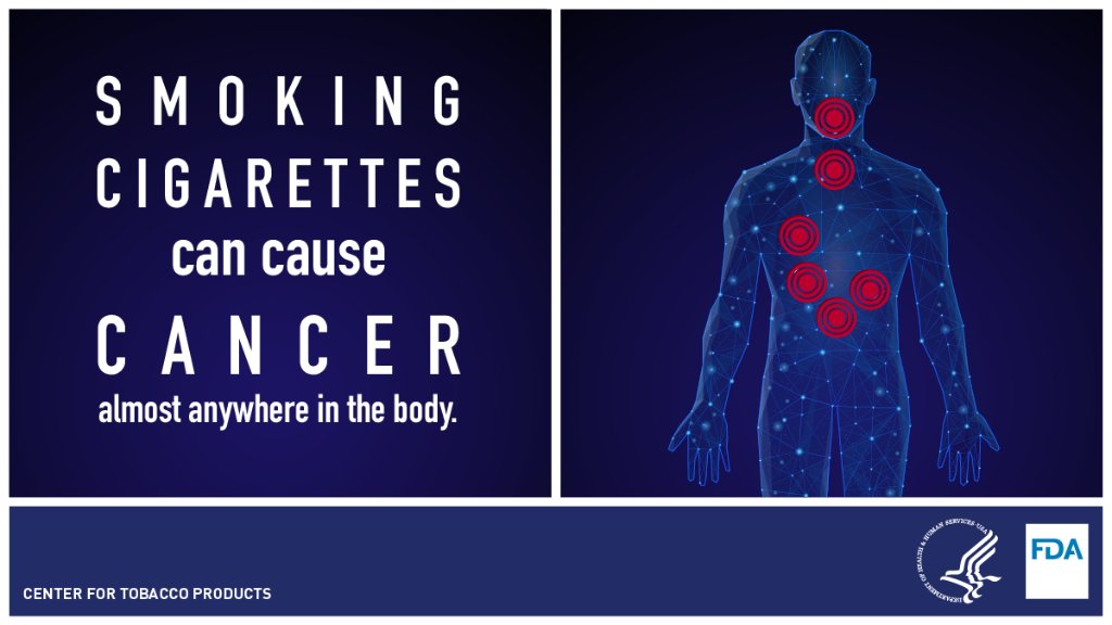 Smoking cigarettes can cause cancer almost anywhere in your body.