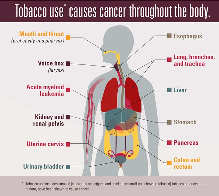 IILAinfo's tweet photo. Tobacco use is the single greatest avoidable risk factor for cancer. #Tobacco smoke has more than 7000 chemicals, at least 250 are known to be harmful &amp; more than 50 are known to cause #cancer - @FCTCofficial 

#WorldCancerDay #IAmAndIWill  #beatNCDs #TobaccoControl #TobaccoTax https://t.co/5C7mdHfBda