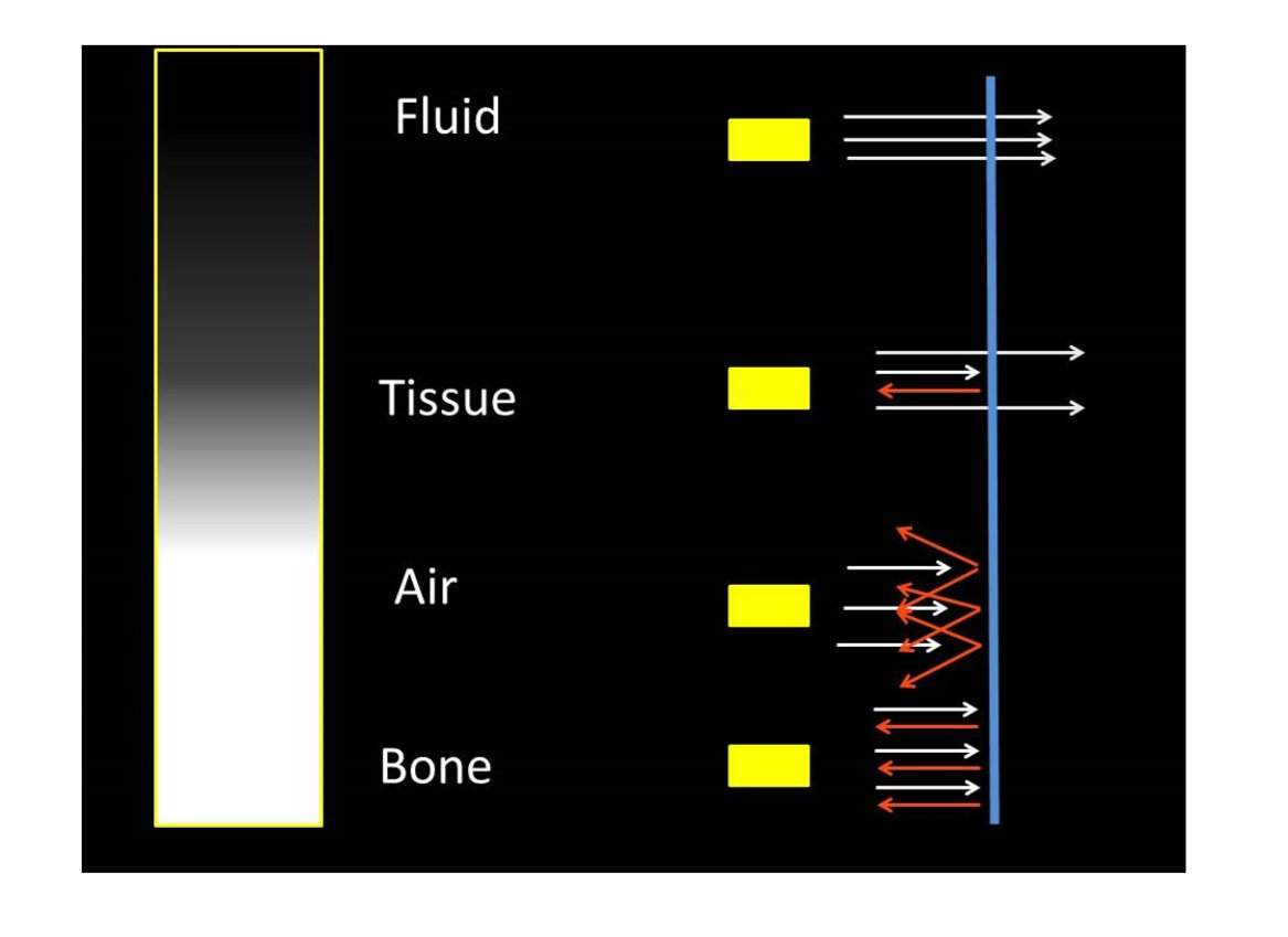 The PoCUS Course (@thepocuscourse) on Twitter photo Our most popular infographic from <a href="/ThePoCUSCourse/">The PoCUS Course</a>
- Understanding what different tissues look like with ultrasound and why.
#POCUS Our most popular infographic from <a href="/ThePoCUSCourse/">The PoCUS Course</a>
- Understanding what different tissues look like with ultrasound and why.
#POCUS