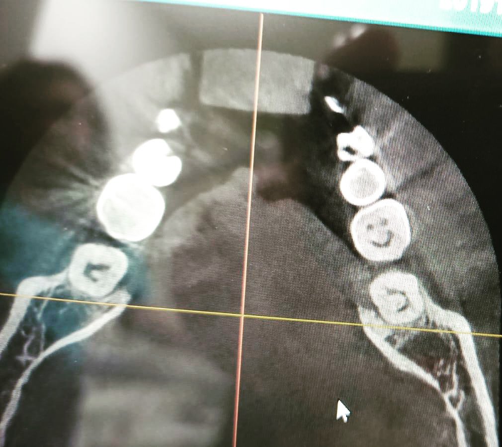 EsprodenSL's tweet photo. Los dientes también sonríen utilizando la mejor tecnología. 
#equipodental #esproden #clinicadental #ergonomia  #dental #sillondental #dentista #odontologia #implantologia #cirugiadental #CBCT #radiografiadental #RX #smile #sonrisa https://t.co/xcPj4y51Ii