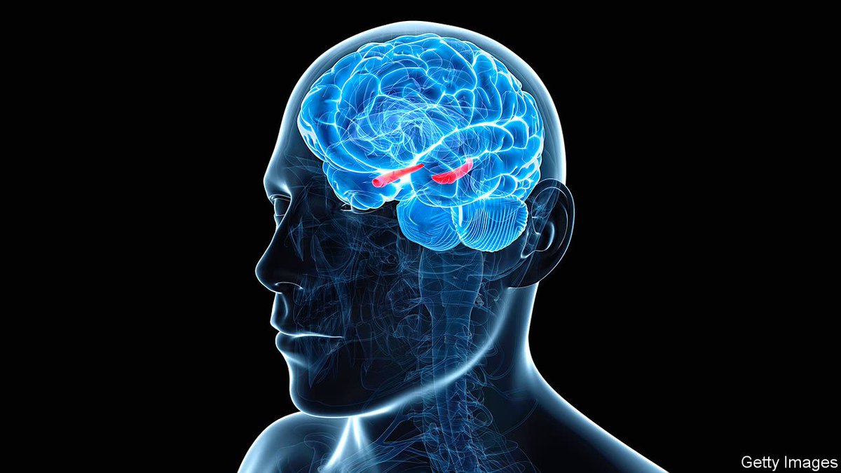 acmTechNews's tweet image. New Insights Into How the Human Brain Solves Complex Decision-Making Problems | News | Communications of the ACM ow.ly/Lrvo30qeZgT #HumanBrain #BrainLikeComputing  #NeuromorphicComputing