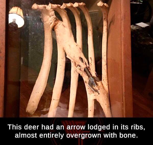 ladderstands's tweet photo. Anyone else have a crazy story like this? #archery #treestandtuesday #treestandbuddy https://t.co/fwVT8eS1Kc