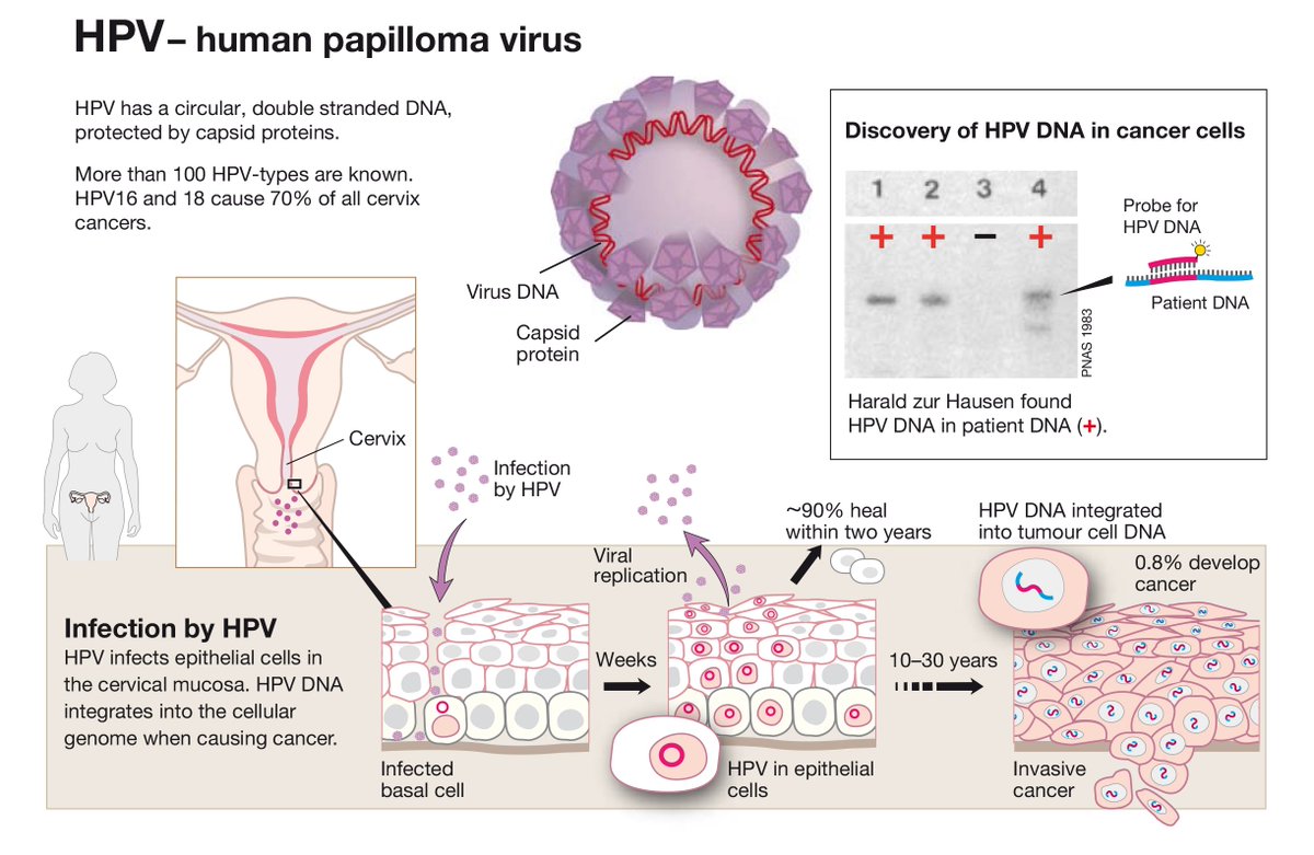 Cancer de utero tiene cura