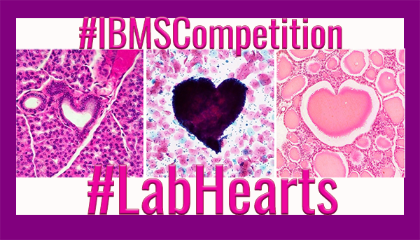 IBMScience's tweet photo. Join us for our February #LabHearts photo competition! This month we want to see photos of your best scientific valentine hearts.
Submit your entries via Facebook, Twitter or to website@ibms.org with the hashtag #IBMSCompetition. May the best heart win! https://t.co/CTpraajEED https://t.co/tYKjas1zlw